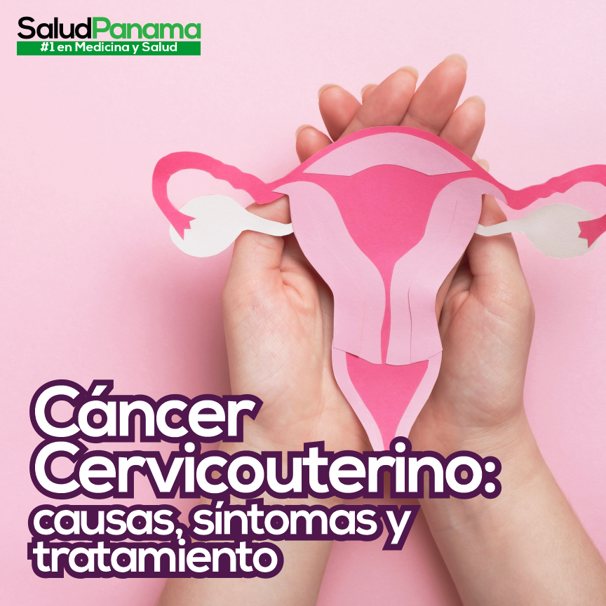 Cáncer Cervicouterino causas síntomas y tratamiento SaludPanama